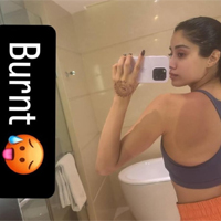 Janhvi Kapoor Gets Sunburnt While Filming in Kochi